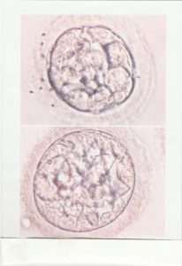 5 day blastocysts